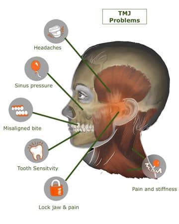 causes of temporomandibular joint dysfunction