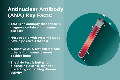 antinuclear-antibody-key-facts