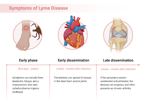 lyme-disease-symptoms