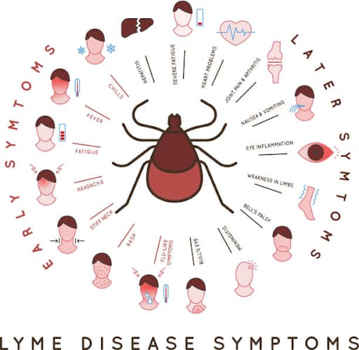 early-signs-of-lyme-disease