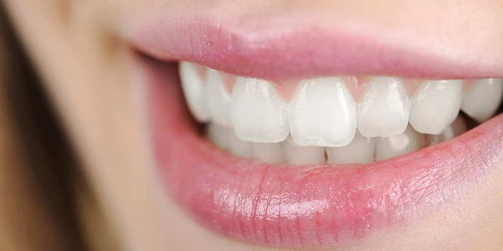 teeth scaling