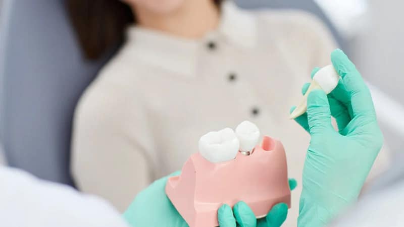 composite bonding nyc