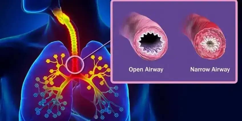 Biomagnetism-Asthma
