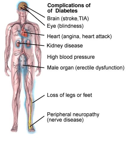 diabetes-and-biomagnetism