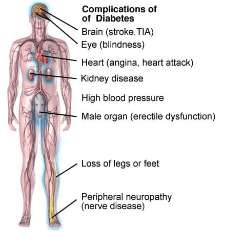 Diabetes and Biomagnetism - Dr Garcia Biomagnetism