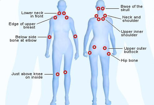 fibromyalgia-biomagnetism