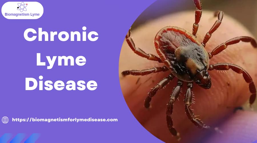 Misdiagnosing chronic Lyme disease is common due to its complicated nature and symptom