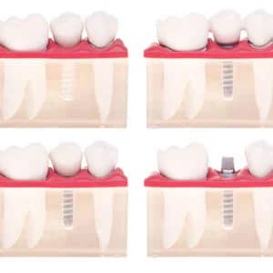 cosmetic dentistry near me