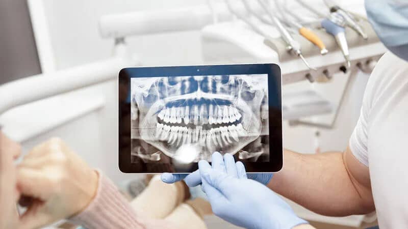 teeth retainer