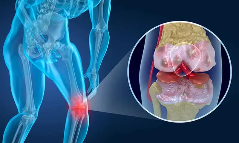 Biomagnetism-Arthrities