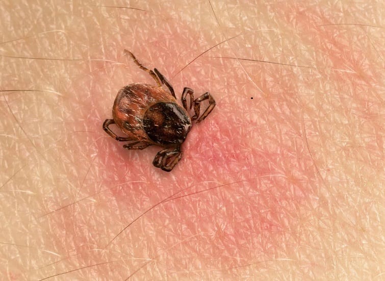 lyme disease treatment