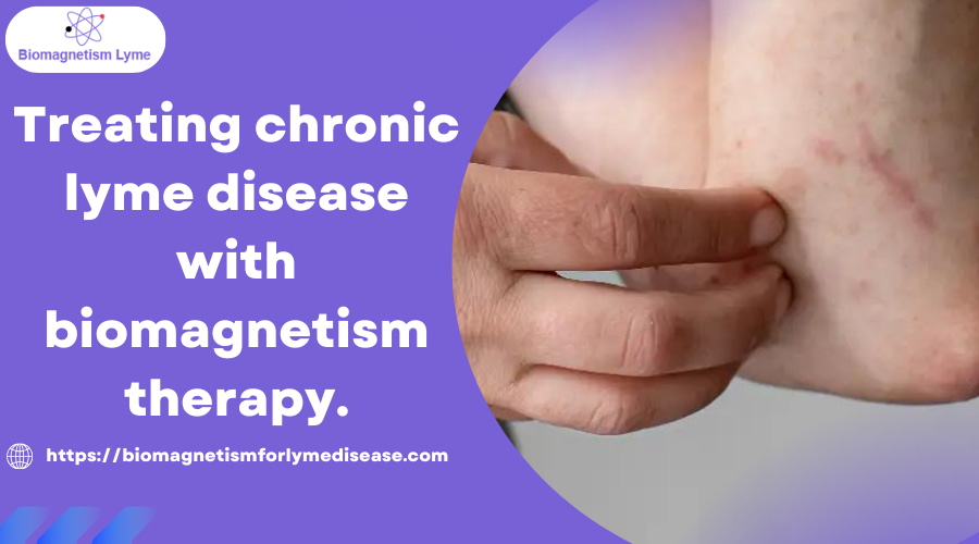 Treating chronic lyme disease with biomagnetism therapy