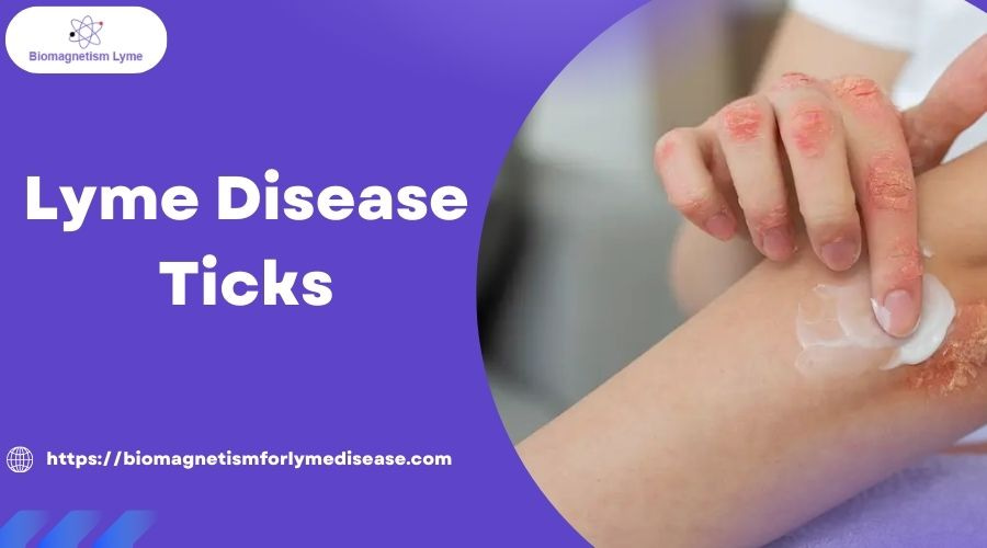 Lyme Disease Ticks infection