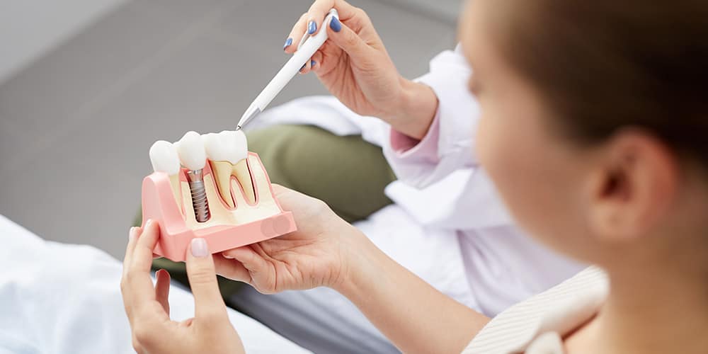 How To Get Best Cheap dental implants NYC Dental Implant cost NY? DrKimWP